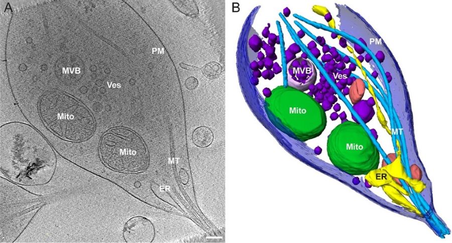 photo and diagram of an axon