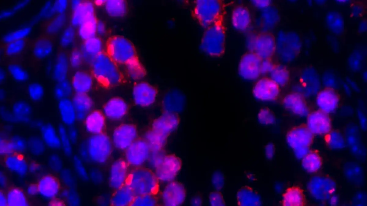 Jumping genes attacking germ cell DNA