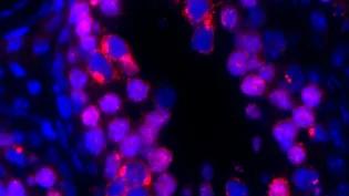 Jumping genes attacking germ cell DNA