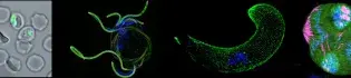 Collage: 1. Red blood cells infected with Plasmodium parasites  2. Male gametocytes explosive response to the mosquito environment  3. Microtubule cytoskeleton of the mosquito invasive ookinete  4. Thousands of sporozoites developing in the mosquito.