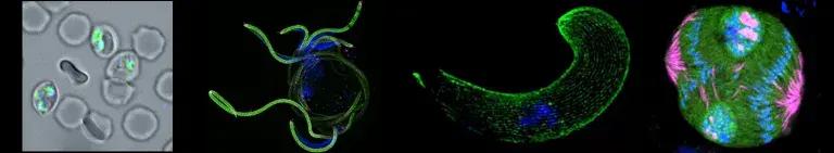 Collage: 1. Red blood cells infected with Plasmodium parasites  2. Male gametocytes explosive response to the mosquito environment  3. Microtubule cytoskeleton of the mosquito invasive ookinete  4. Thousands of sporozoites developing in the mosquito.