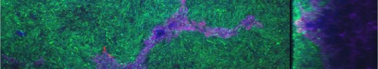 Immunofluorescence cells