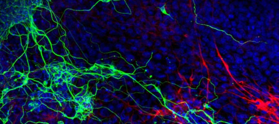 Biophysics of AMPA-type Glutamate Receptors Group