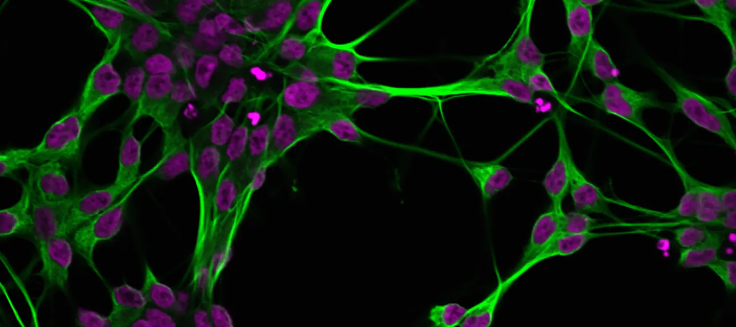 Fluorescence image of neurons