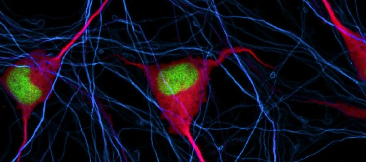 stained cells
