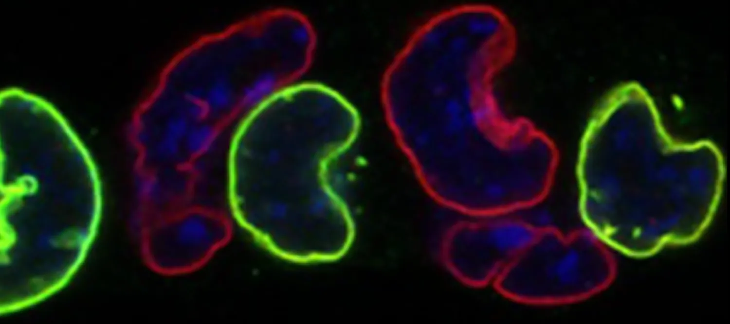 Microscopic image of cells in green, red and purple on a black background