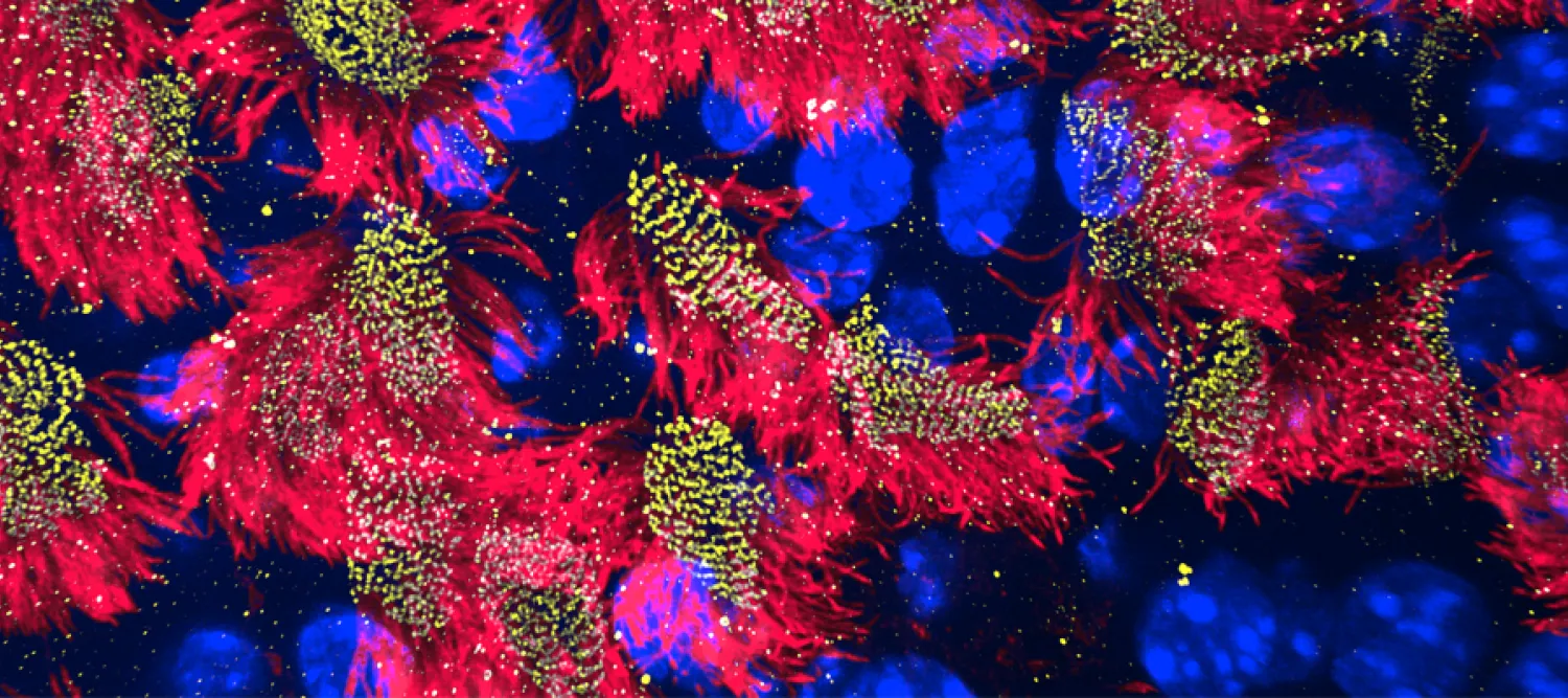 cilia coloured red