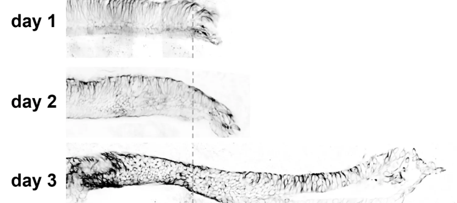 tail regeneration in the axolotl