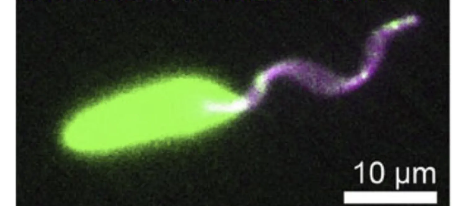 Leishmania parasite