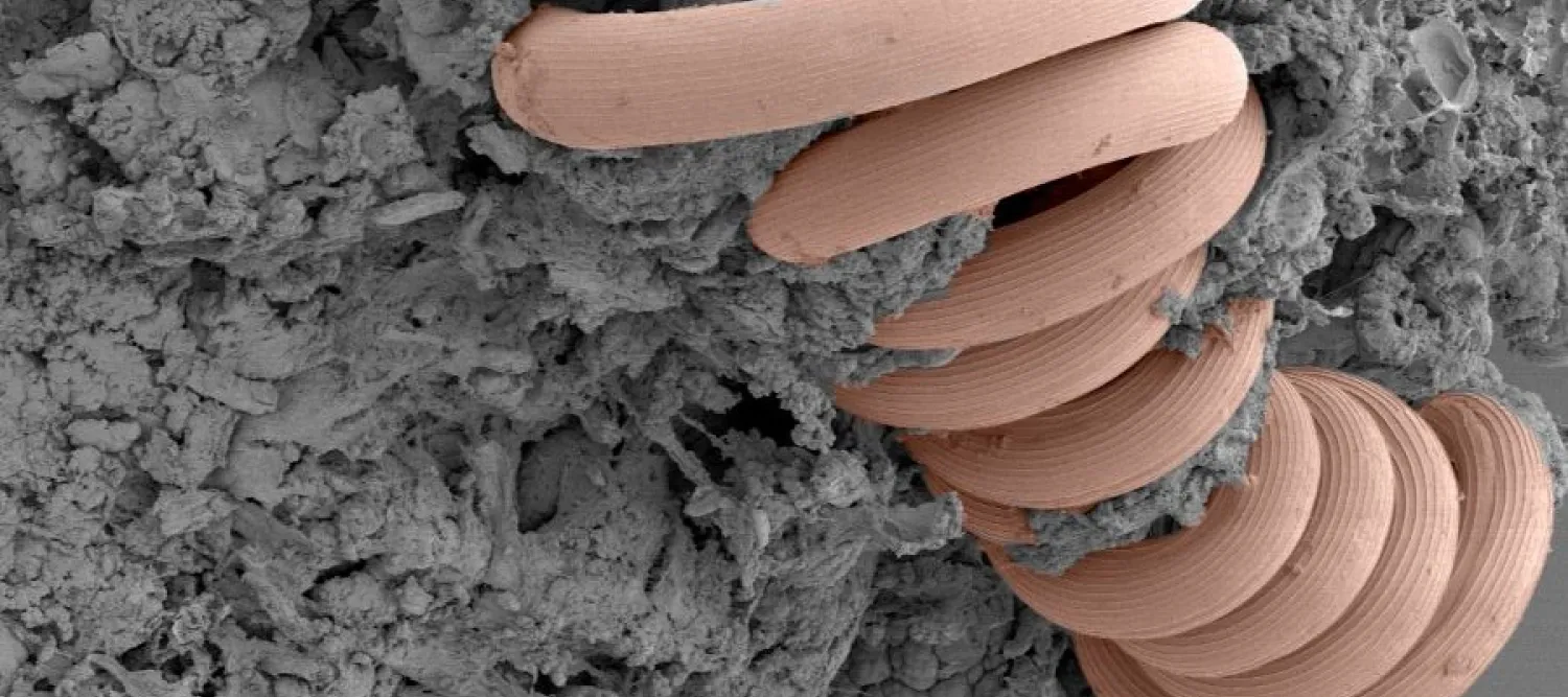 Image of the nematode Heligmosomoides bakeri 