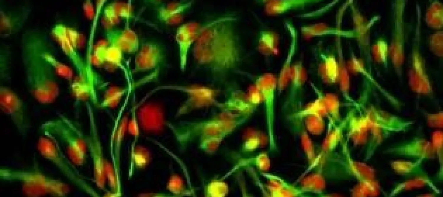 Glioblastoma cells