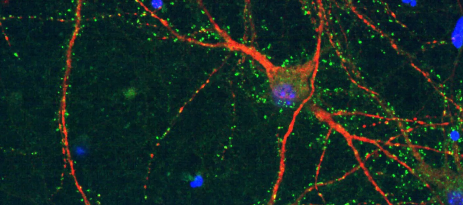 fluorescence images of glutamate receptors