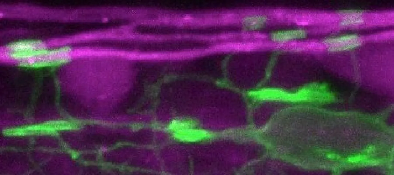 fluorescence image of zebrafish axons