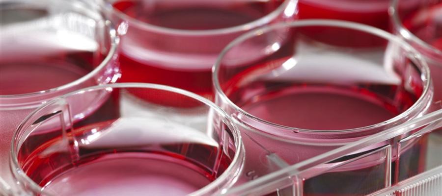 Dark Red Tissue Culture 