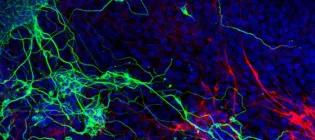 Biophysics of AMPA-type Glutamate Receptors Group
