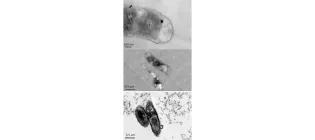 Diagram for Joshi et al (2012) - see text for article link.