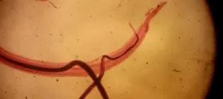 A pair of schistosoma mansoni parasites (Alaa/Wikimedia Commons )