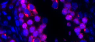 Jumping genes attacking germ cell DNA
