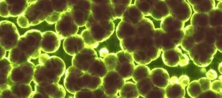 Bacteria