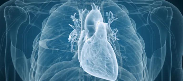 Heart disease