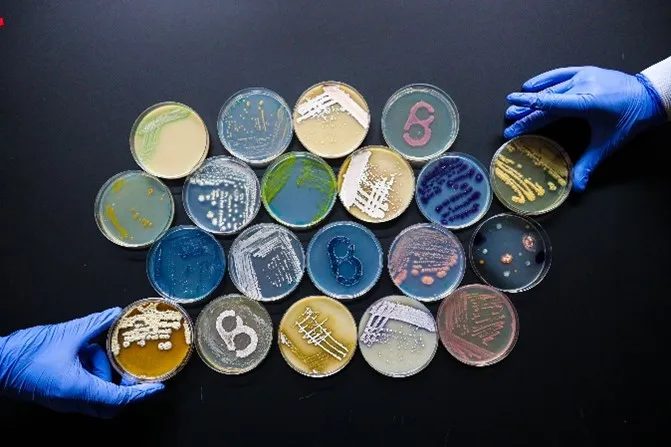 image of petri dishes with letter B