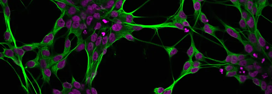Fluorescence image of neurons