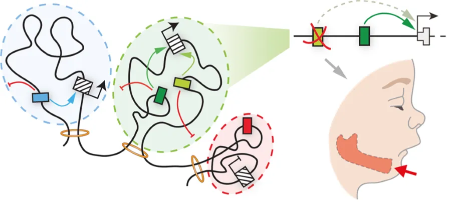 Diagram of how gene regulation effects craniofacial development