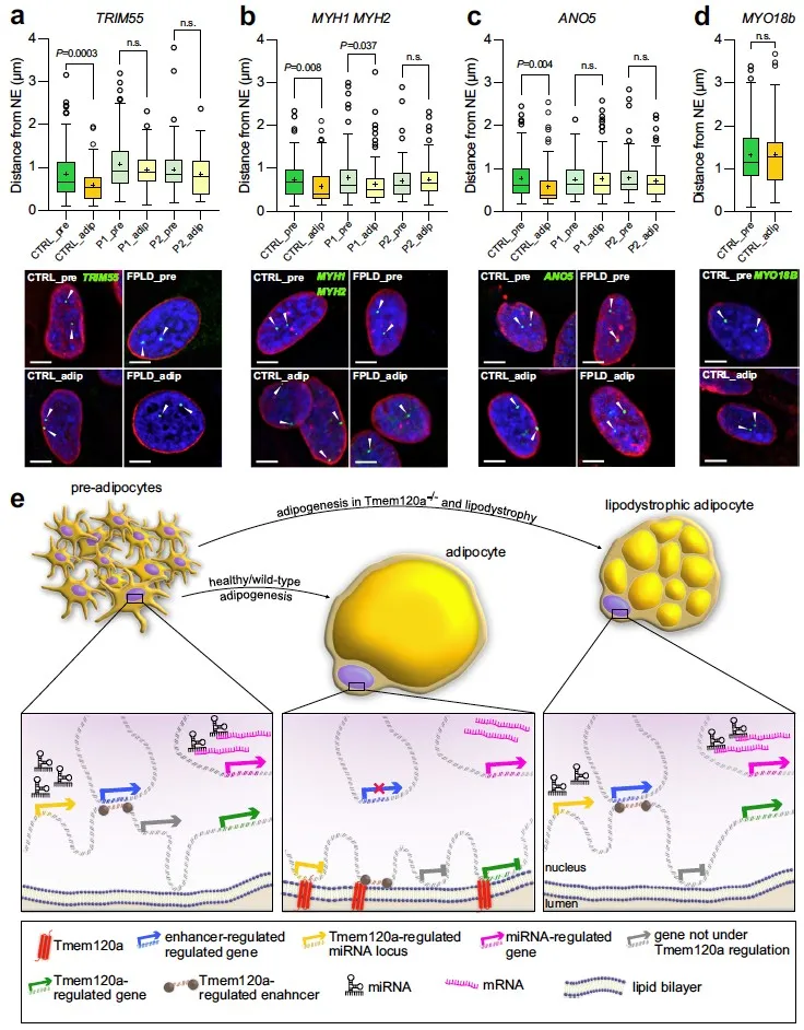 figure showing the link between gene misregulation and human lipodystrophy
