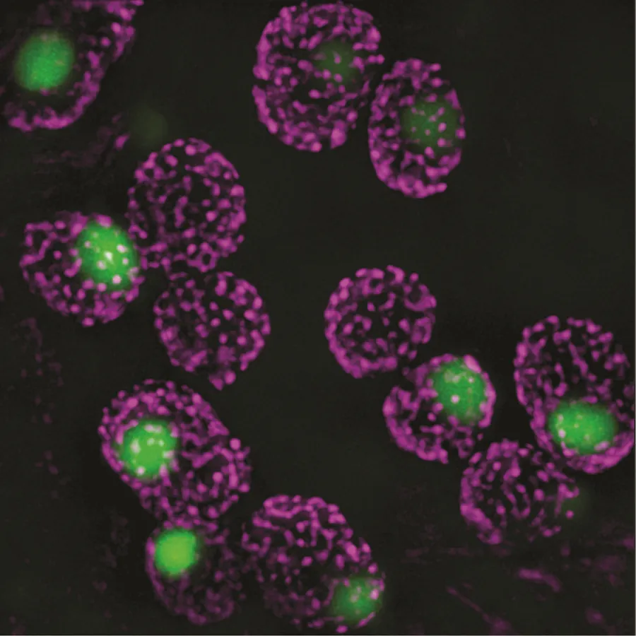 SIM microscopy image of the proto-pyrenoid inside a plant (Arabidopsis) chloroplast