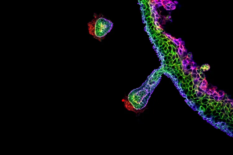 Image of a human skin organoid derived entirely from pluripotent cells