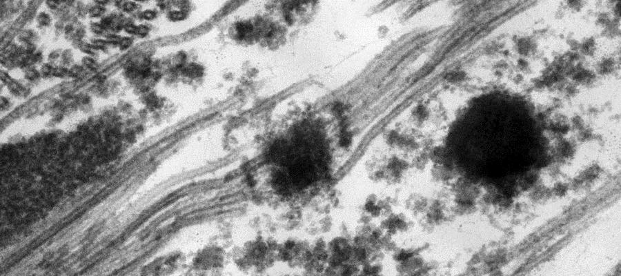 Transmission electron micrograph of a Kinetochore attached to microtubules