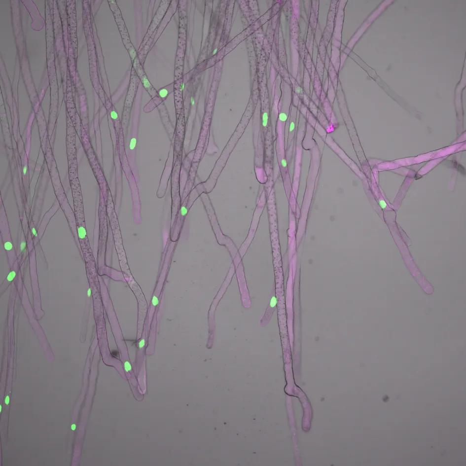 Photo of rhizoid cells in Marchantia. More details in page text.