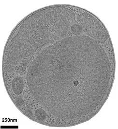 Microscopic image of a cell in black and white
