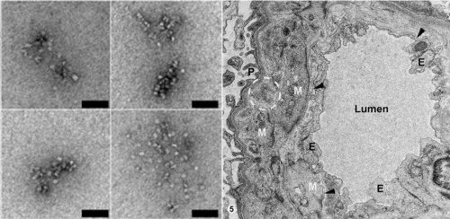 electron micrographs of nucleosomes and Kidney