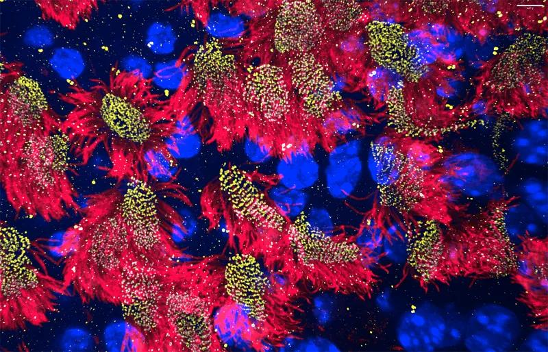 fluorescence image of cilia (red)