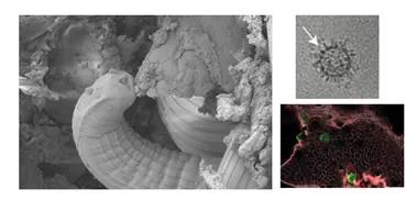 Photo of a nematode infecting mouse intestine
