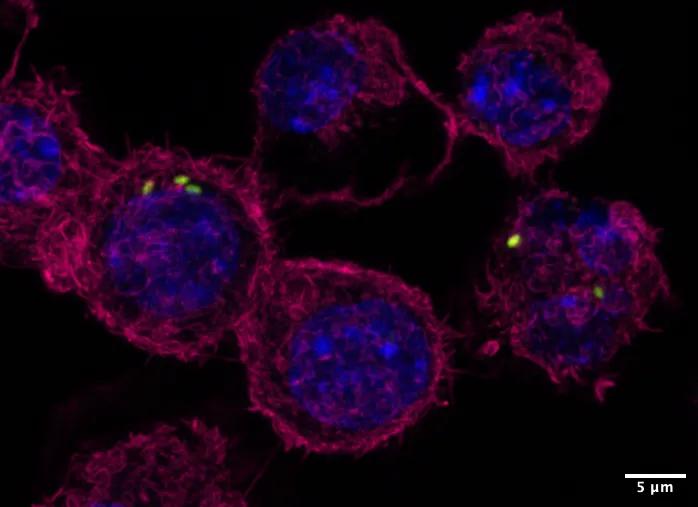 Microscopy image of macrophages infected with Pseudomonas aeruginosa