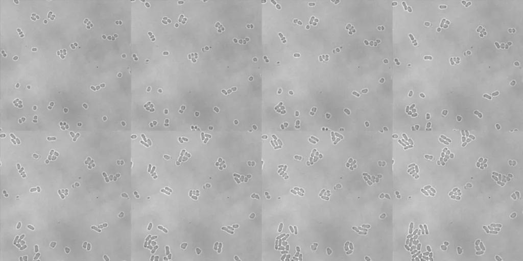 Montage image of L-form bacteria through time