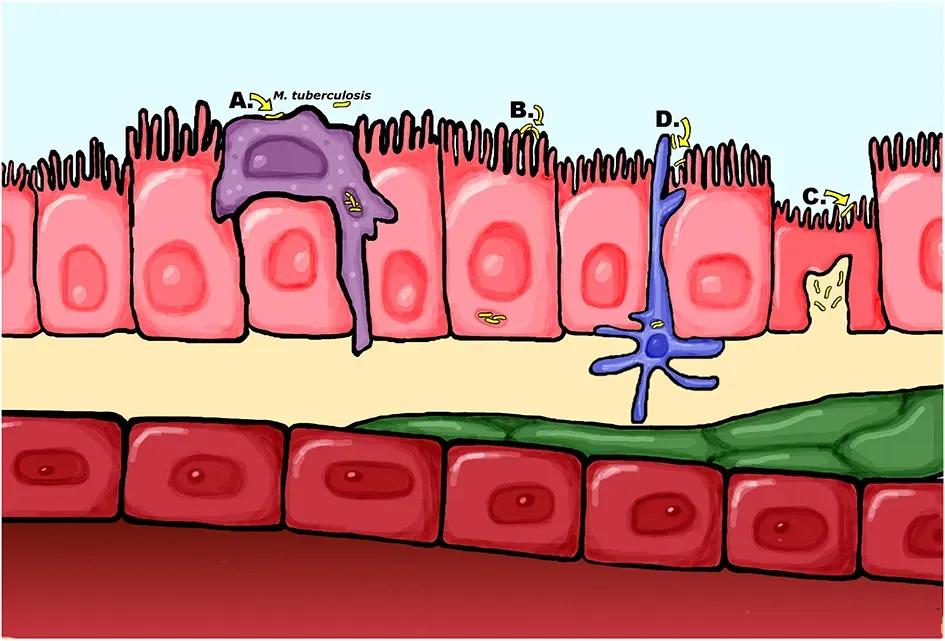 Illustration of possible TB dissemination routes