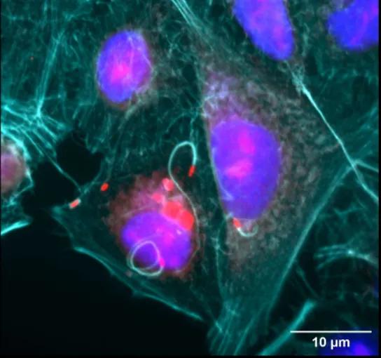 Image showing Burkholderia formin actin tails within cells