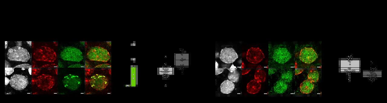Cells showing the fluorescent localisation oh heterochromatin (HP1) and SPOCD1