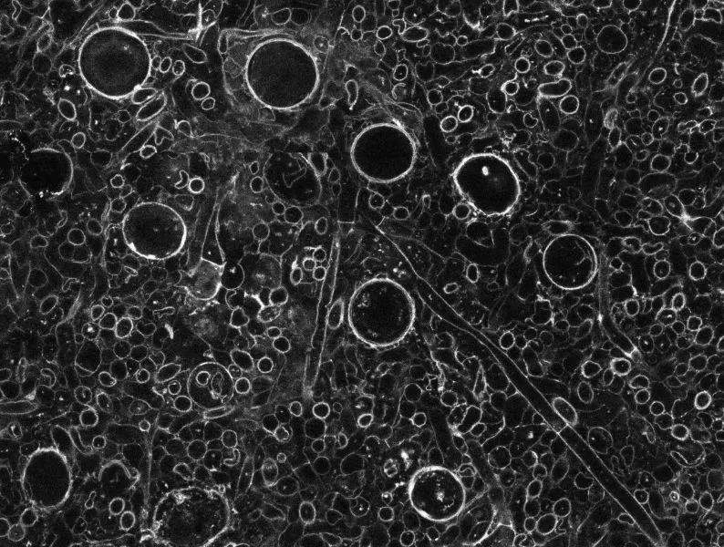 Image of the microscopic tubes that comprise the body of Prototaxites taiti