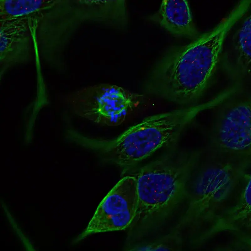 Before Deconvolution