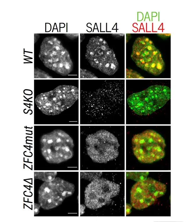 SALL4 binding to AT-rich heterochromatin depends on zinc finger cluster 4 (ZFC4)