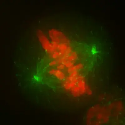 Electron microscope cell image in green and red