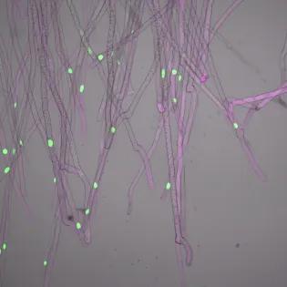 Photo of rhizoid cells in Marchantia. More details in page text.