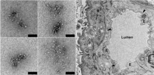 electron micrographs of nucleosomes and Kidney