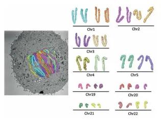 Painted chromosomes in a dividing cell
