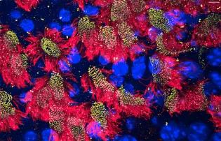 fluorescence image of cilia (red)