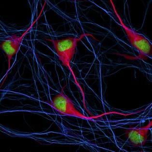 fluorescence image of neuronal cells